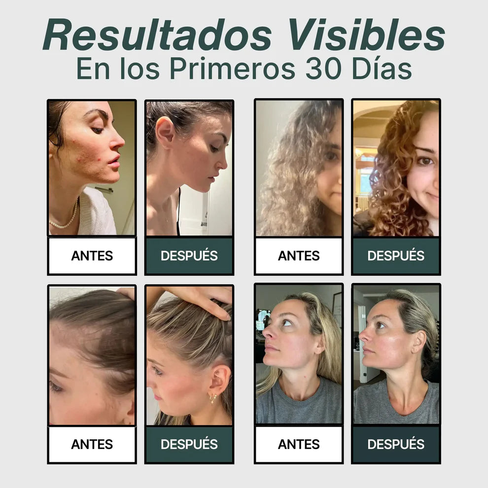 Aguapura | Salvá tu piel, tu pelo y tu salud del desastre del agua con sarro.